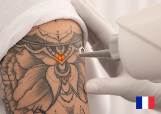 CCT Détatouage